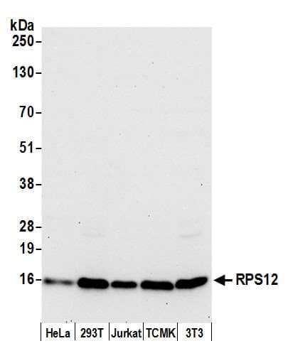 Polyclonal Rabbit anti-Human RPS12 / Ribosomal Protein S12 Antibody (aa50-100, WB)