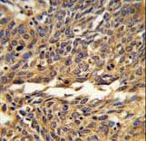 Polyclonal Rabbit anti-Human EXOC5 Antibody (aa40-66, IHC, WB)