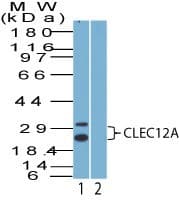Polyclonal Rabbit anti-Human CLEC12A / CD371 Antibody (aa170-220, WB)