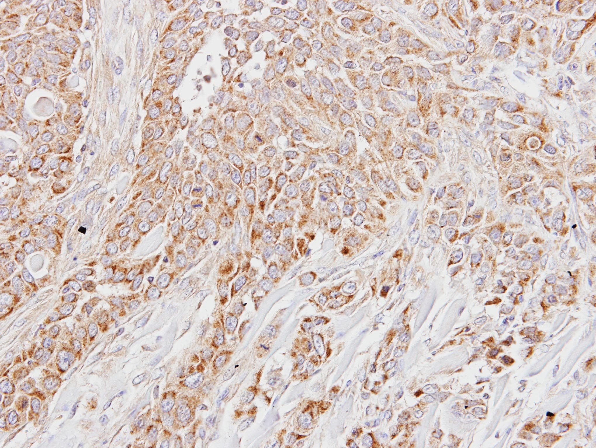 Polyclonal Rabbit anti-Human LETM1 Antibody (aa506-723, IHC, WB)