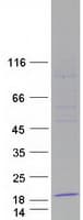Human C1orf151 Protein (Recombinant Myc-DDK (Flag))