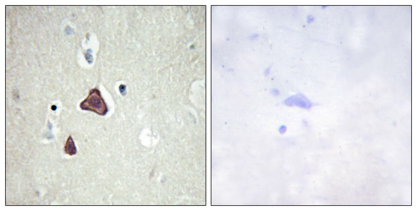 ADCY8 / Adenylate Cyclase 8 Antibody (aa591-640)