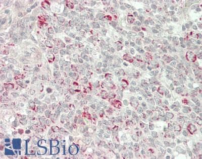 IHC-plus™ Polyclonal Rabbit anti-Human GPX4 / MCSP Antibody (IHC, IF, WB)