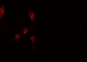 STAT5A Antibody (phospho-Ser725,pSer730)