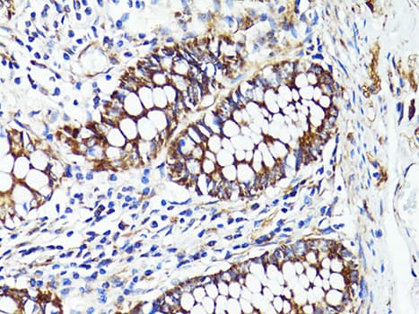 Polyclonal Rabbit anti-Human S100A10 Antibody (IHC, WB)