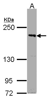 Polyclonal Rabbit anti-Human PAS Kinase / PASK Antibody (aa930-1323, WB)