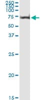 AKT1 Antibody (clone 2E11)