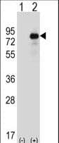 HIPK4 Antibody