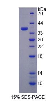 Human Rhodanese / TST Protein (Recombinant His, N-Terminal)