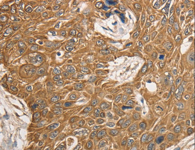 Polyclonal Rabbit anti-Human KCNC1 / Kv3.1 Antibody (IHC, WB)