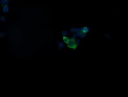 IHC-plus™ Monoclonal Mouse anti-Human GBAS Antibody (clone 1B8, IHC, IF, WB)