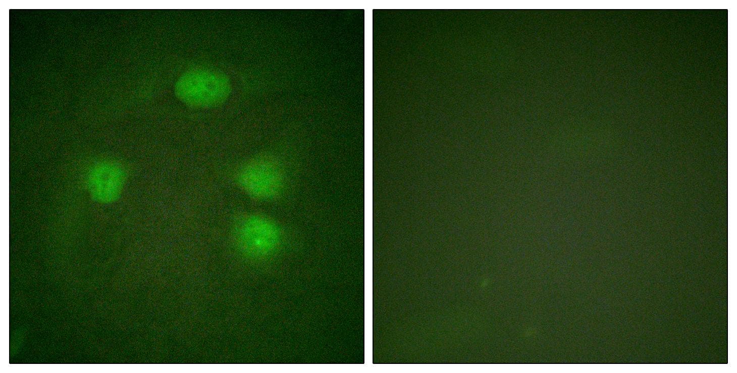 KCNJ3 / GIRK1 Antibody (p185)