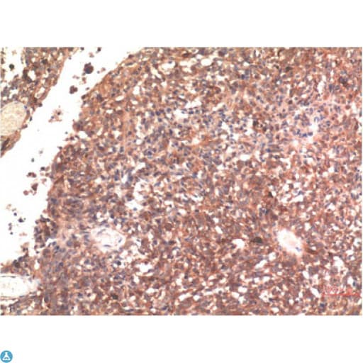 MAPT / Tau Antibody