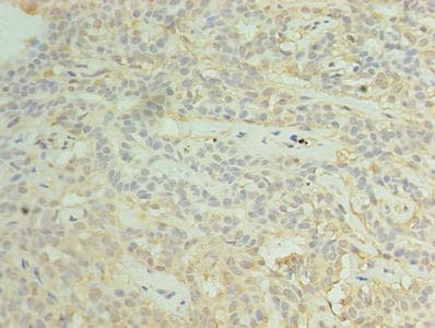 RBM11 Antibody