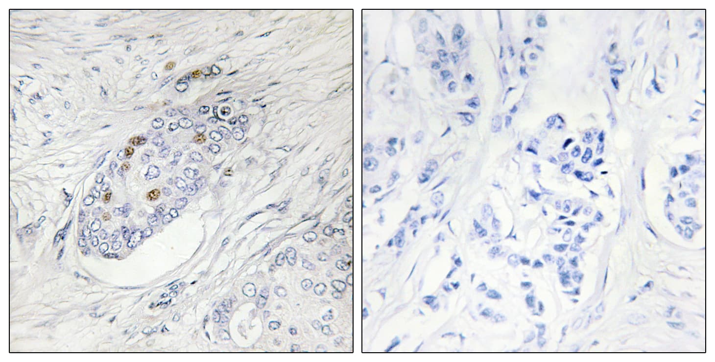 Polyclonal Rabbit anti-Human ZNF232 Antibody (aa171-220, IHC)
