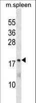 Polyclonal Rabbit anti-Human HsT19268 / MTHFS Antibody (aa133-159, WB)