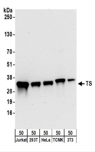 TS / Thymidylate Synthase Antibody (aa263-313)