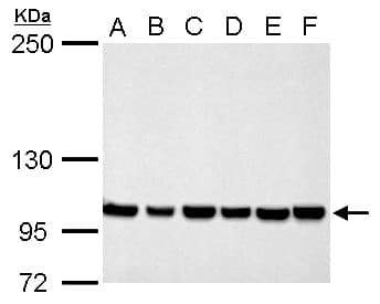 Polyclonal Rabbit anti-Human CSE1L Antibody (aa222-469, IHC, WB)