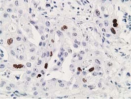 Monoclonal Mouse anti-Human TP53 / p53 Antibody (clone OTI3D5, IHC, IF, WB)