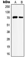 HSPA8 / HSC70 Antibody (Internal)