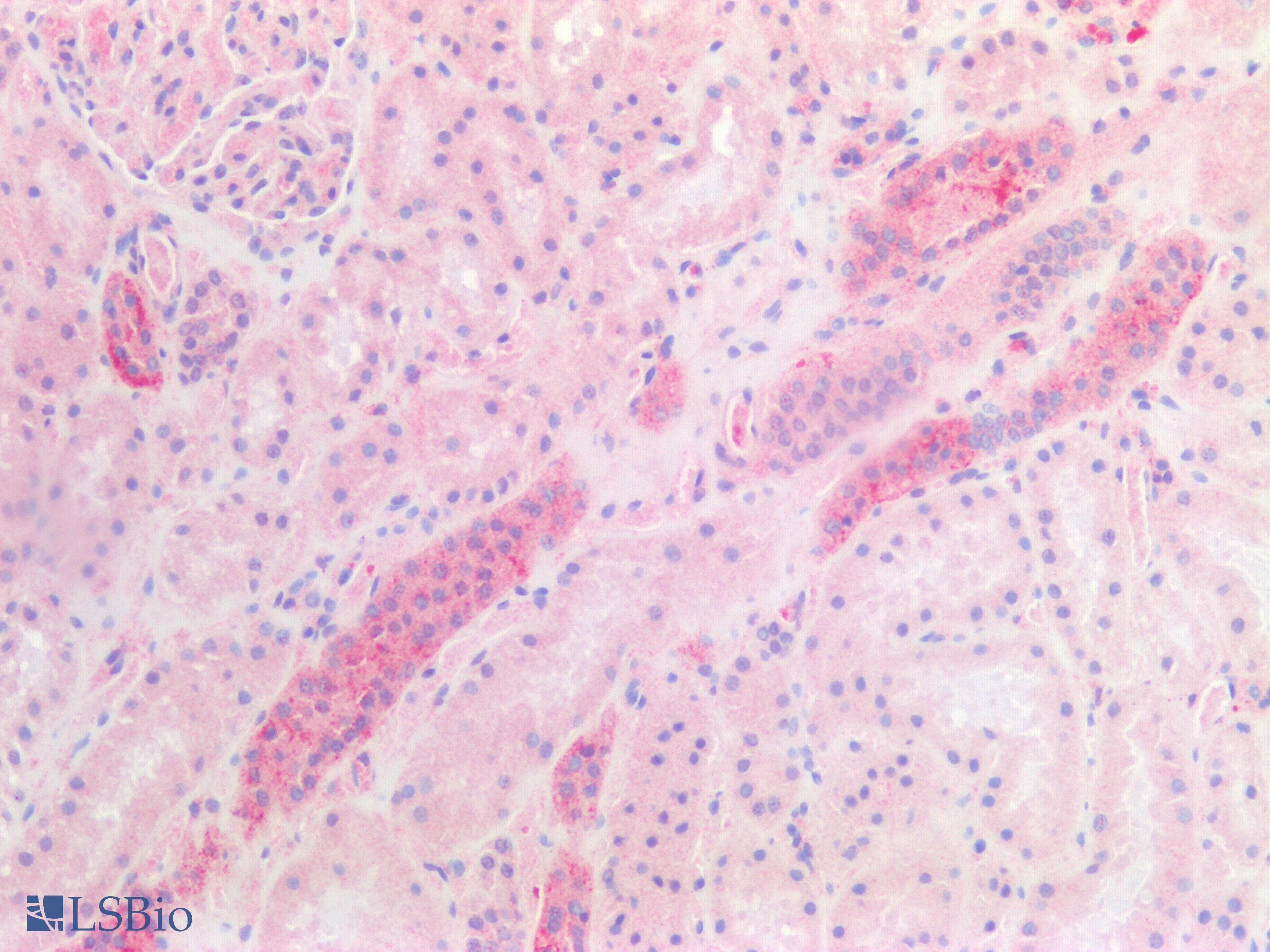 IHC-plus™ UCHL1 / PGP9.5 Antibody (C-Terminus)