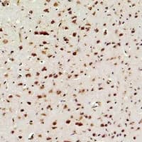 RELA / NFKB p65 Antibody
