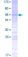 Human SPDYE2 Protein (Recombinant GST)