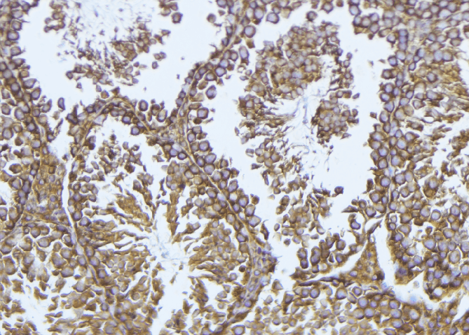 GPX4 / MCSP Antibody