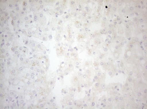 Monoclonal Mouse anti-Human BCL2L14 / BCL-G Antibody (clone OTI6D1, aa116-216, IHC, WB)