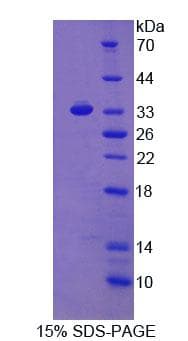 Rat Osteonectin / SPARC Protein (Recombinant His)