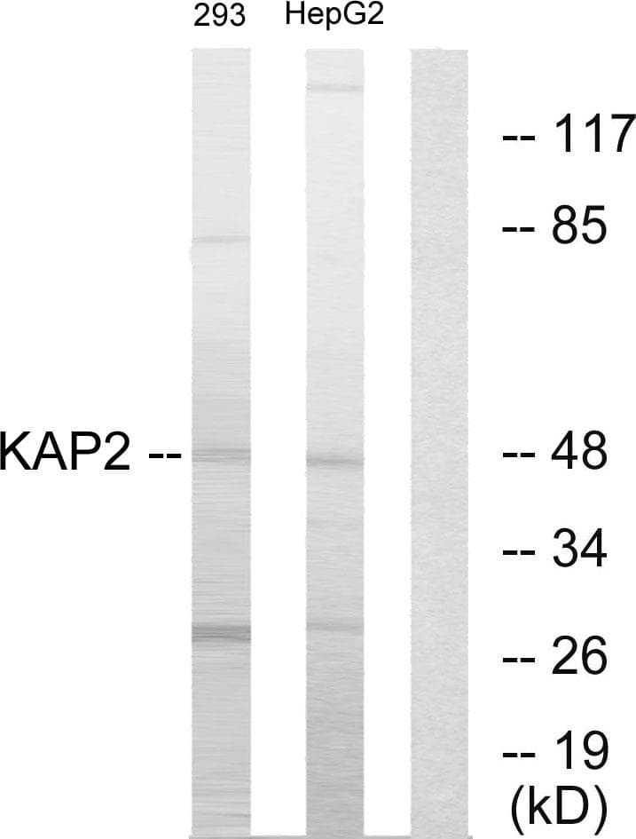 cAMP-Dependent Protein Kinase Type II Regulatory Subunit Antibody