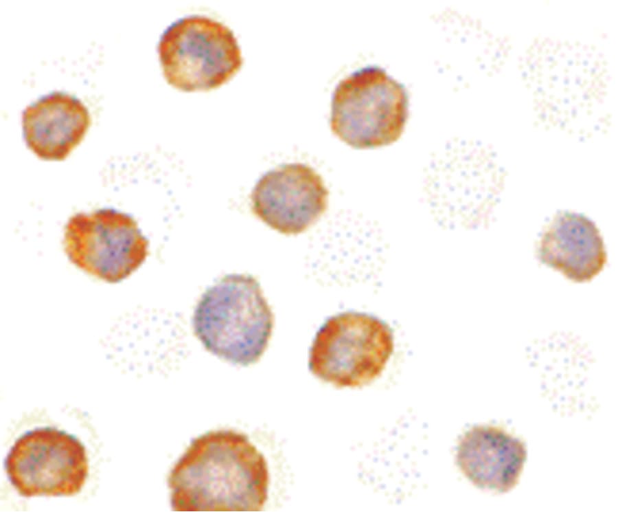 IHC-plus™ Polyclonal Rabbit anti-Human RICK / RIP2 Antibody (IHC, IF, WB)