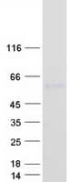 Human UGT1A8 Protein (Recombinant Myc-DDK (Flag))