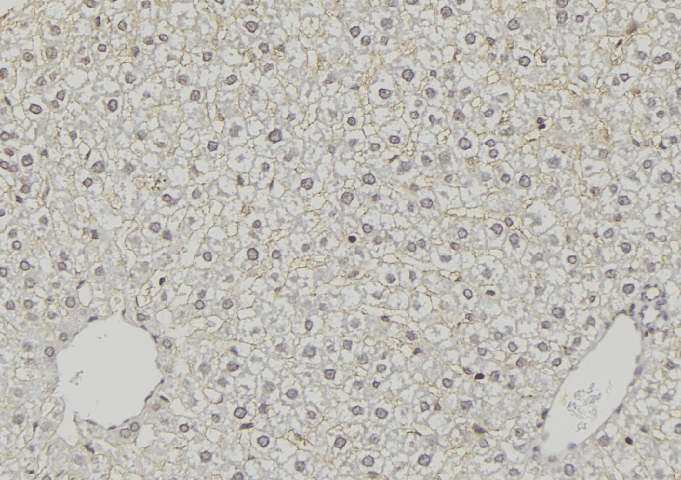 Polyclonal Rabbit anti-Human ACSS1 Antibody (IHC, IF, WB)