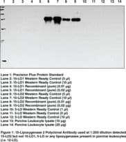 IHC-plus™ Polyclonal Rabbit anti-Human ALOX15B / 15-LOX-2 Antibody (aa161-179, IHC, WB)