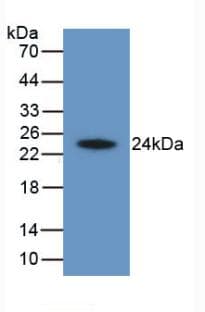 HAVCR2 / TIM-3 Antibody