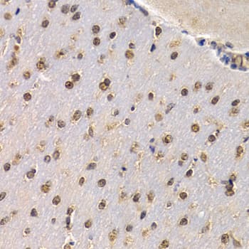 Polyclonal Rabbit anti-Human RAD1 Antibody (IHC, IF, WB)