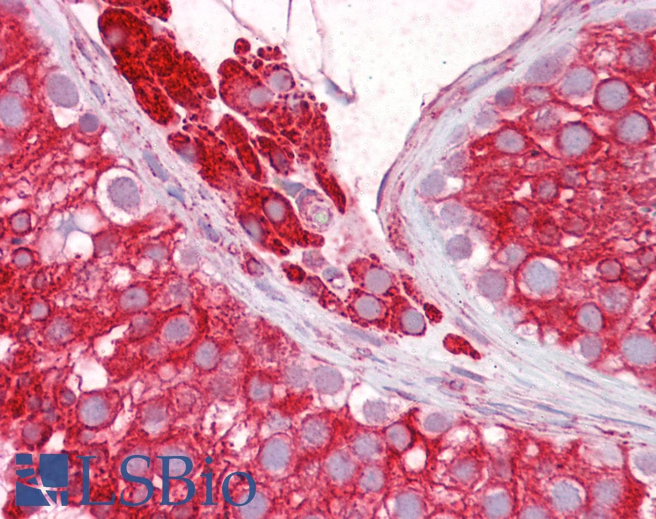 IHC-plus™ RTN4 / Nogo Antibody (aa14-30)