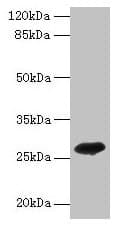 Adiponectin Antibody