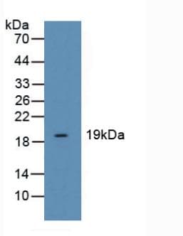 CFL1 / Cofilin Antibody (aa3-161, APC)