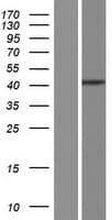 MURF1 / IRF Protein (Over-Expression Lysate Myc-DDK (Flag))