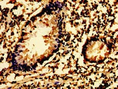 SYK Antibody