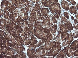MAP2K1 / MKK1 / MEK1 Antibody (clone OTI2B2, Carrier-free)