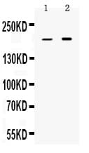 PPL / Periplakin Antibody