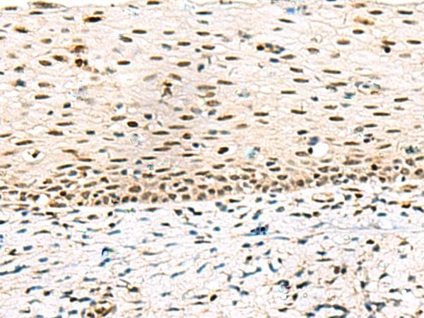 ABI2B / ABI2 Antibody
