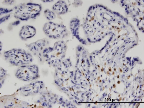 Monoclonal Mouse anti-Human IRF5 Antibody (clone 2G9, IHC, WB)