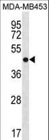 ANXA13 / Annexin XIII Antibody (aa1-30)