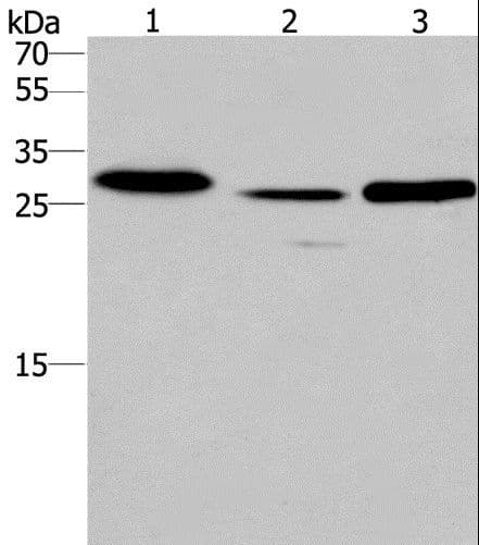 Polyclonal Rabbit anti-Human SIMPL / IRAK1BP1 Antibody (IHC, WB)