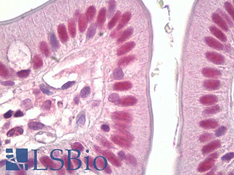 IHC-plus™ Polyclonal Rabbit anti-Human RPS6KA5 / MSK1 Antibody (aa331-380, IHC, WB)