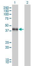 Monoclonal Mouse anti-Human DLX3 Antibody (clone 4F8, WB)